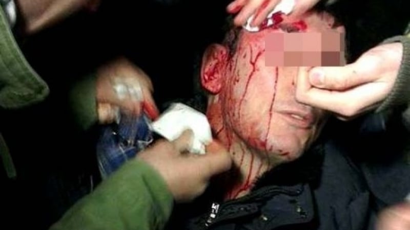 Пореден пиянски погром в пловдивско заведение завърши с линейки и полиция 