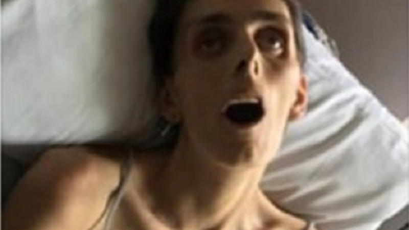 Фейсбук цензурира разтърсваща СНИМКА (18+) на млада жена, умираща от рак 