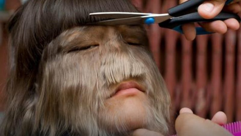 "Девойката върколак" обръсна за пръв път голямата си брада (ВИДЕО)