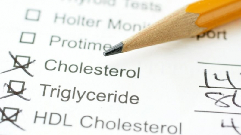 Обърнете внимание! Ето ги 7-те признака за повишен холестерол