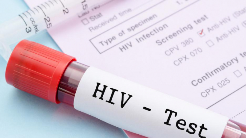 20 признака, които показват, че може да сте жертва на ХИВ