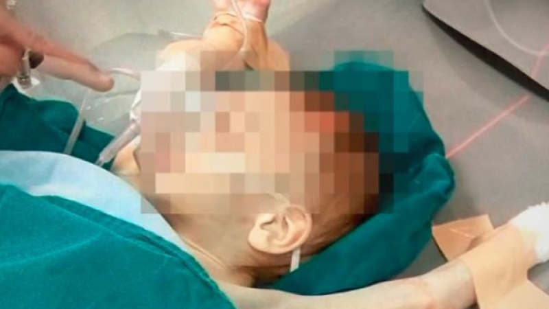 Най-сетне добра новина за 3-годишното близначе, което изпадна в кома след инцидент в дома си 
