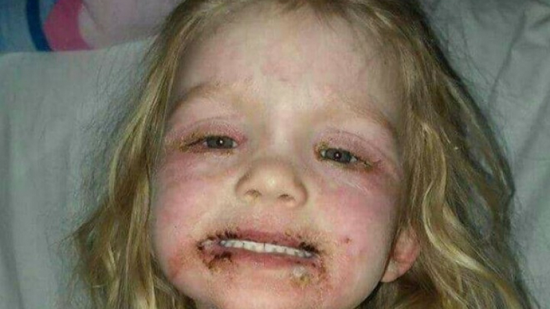Майка купи на момиченцето си уж безвредна детска козметика, но преживя най-ужасния си кошмар (СНИМКИ)