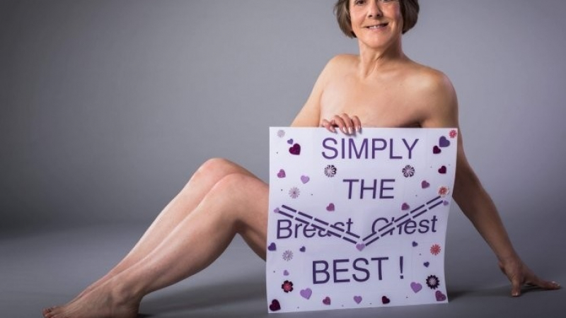 Пациентка с ампутирана заради рак гърда поиска да ѝ отрежат и другата, за да позира гола и да се чувства комфортно (СНИМКИ 18+)