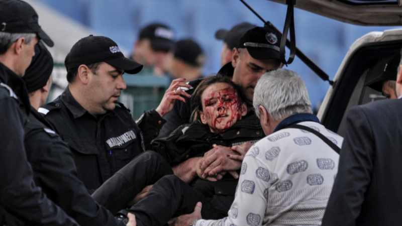 Министър Радев с остър тон: Да си сложим по една марля на окото и да работим така, за да видим какво й е на ранената полицайка
