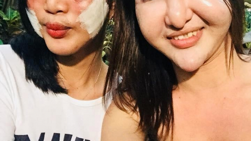 Страшна гледка: Две приятелки решиха да бъдат красиви и отидоха на козметик. Вече 10 години всички им се присмиват (СНИМКИ)