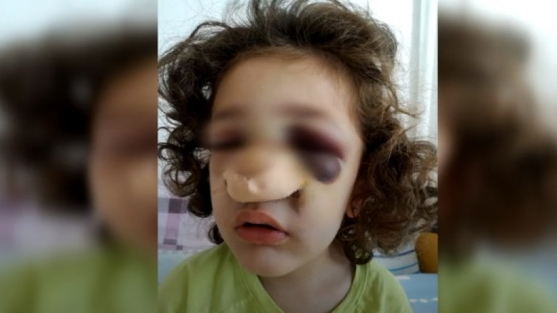 Страшен инцидент с 4-годишно дете в забавачка, учителката - мълчи