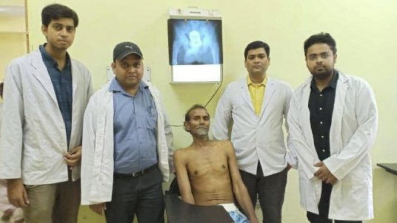 62-годишен индиец живя 10 дни с чаша в ануса, а пред смаяните лекари обясни, че... (СНИМКИ)