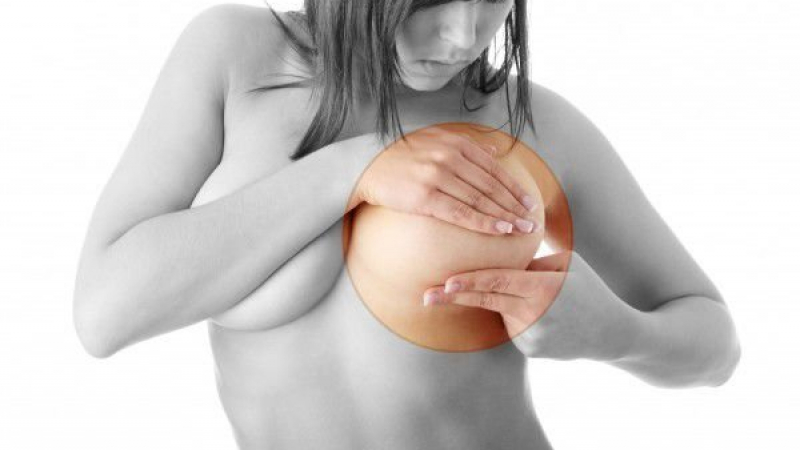 Експерти категорични: Предпазете се от рак на гърдата като консумирате...
