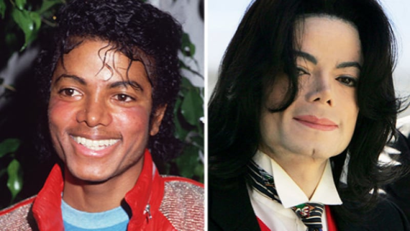 Приятелка на Майкъл Джексън разкри тайната за смяната на цвета на кожата му