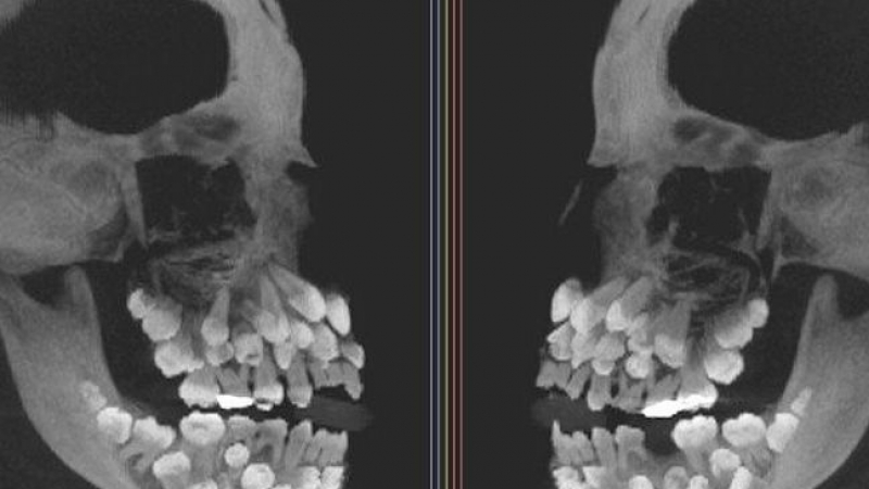 19 странни рентгенови СНИМКИ за тези, които мислят, че са видели всичко