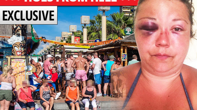 Три жени пребиха жестоко британска туристка в Испания (СНИМКА)