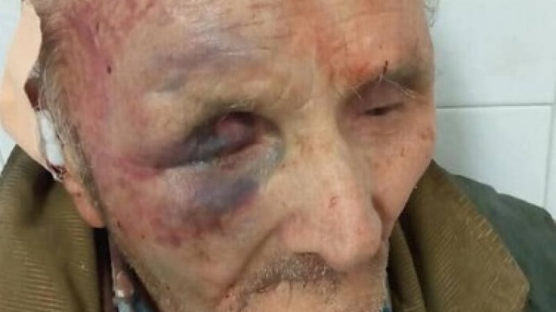 Само в БЛИЦ! Кикбоксьор изригна: Циганин преби брутално дядо ми в Славяново! 120 лева спасили живота на пенсионера (СНИМКИ 18+)