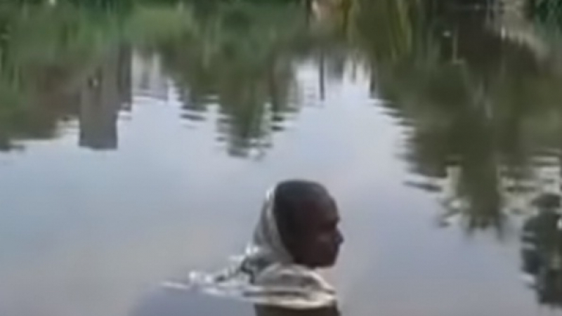 Жена се кисне в езеро по цял ден от 20 години насам заради рядка болест