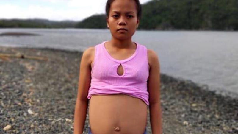 17-годишна ученичка внезапно забременя от риба, на видеозона се видя... (СНИМКИ)