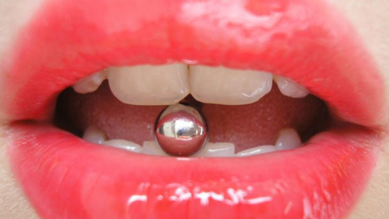 9 основни причини за появата на метален вкус в устата