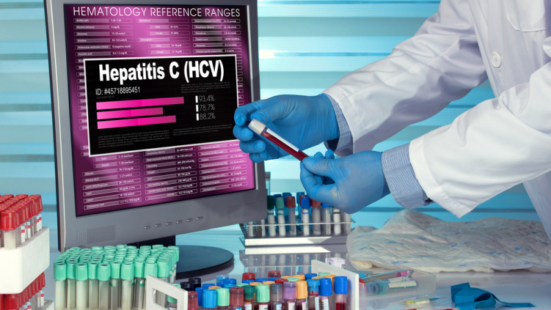 Откриха 30 нови случая на хепатит В и С само за три месеца, а заразените с ХИВ са…