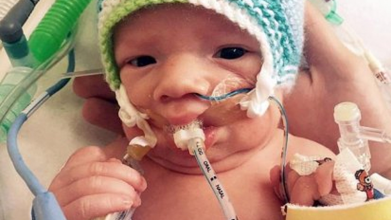 Лекари даваха само няколко минути живот на малко бебче, но се случи чудо (СНИМКИ)