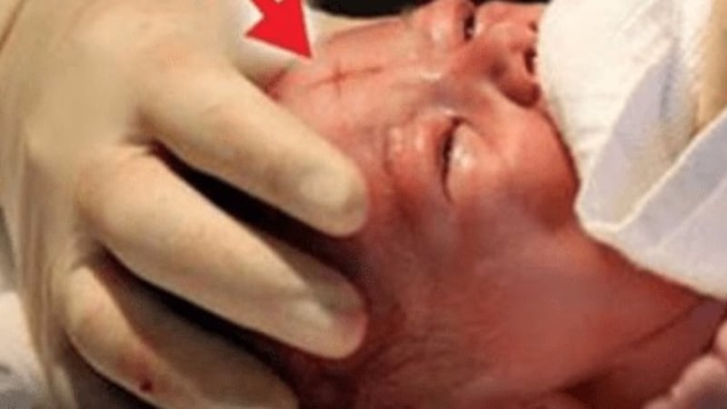 Това ли е новият месия: Бебе с кръст на челото се роди в Мексико! 