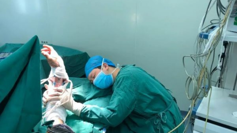 Хирург извърши 6 операции и заспа на масата, държейки пациент за пришитата му ръка