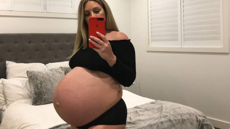 Млада австралийка показа СНИМКИ на бременното си коремче в мрежата и съжали жестоко 