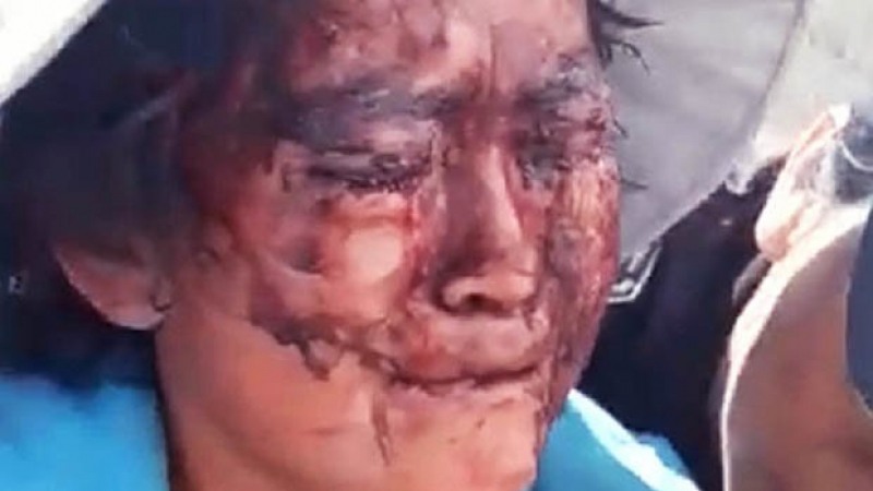 Брутално: Мъж надупчи лицето на жена си с отвертка, шокиращи СНИМКИ 18+