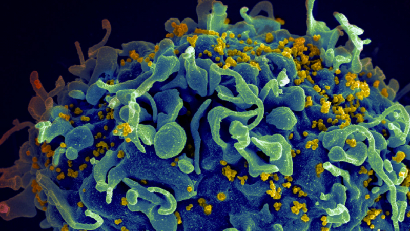 Това ли е лекът срещу ХИВ? Учени излекуваха трети пациент от смъртоносната болест