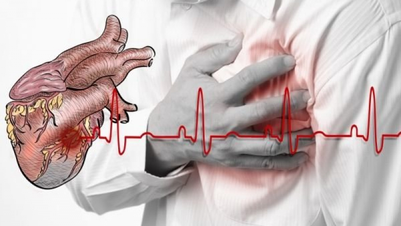 Кардиолози бият тревога: Бум на инфарктите на 3 април!