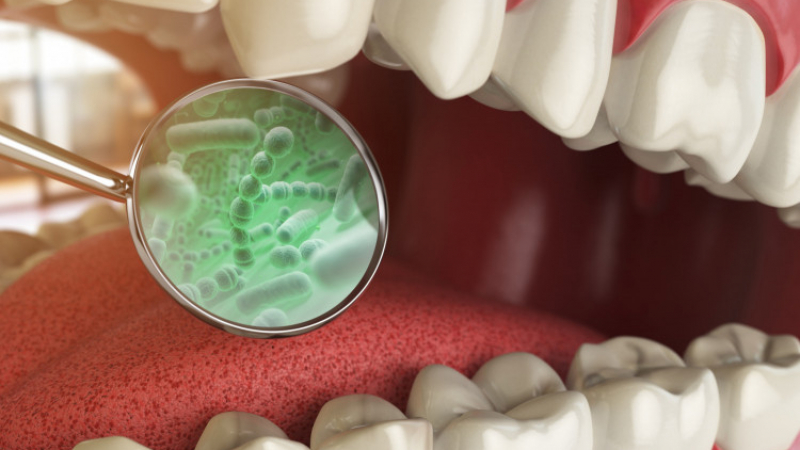 Една трета от хората с колоректален рак имат тази бактерия в устатата си