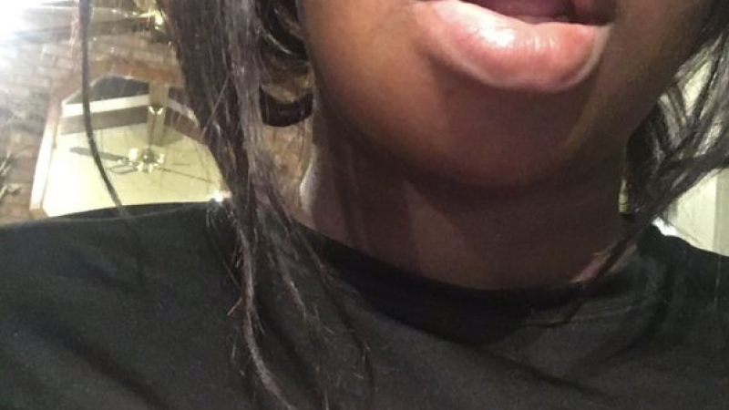 Млада американка показа подутите си устни и стана сензация в мрежата (СНИМКИ/ВИДЕО)