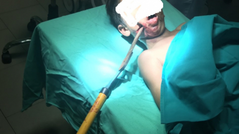 Хирурзи от Бургас извършиха операция, която ще влезе в учебниците (СНИМКИ/ВИДЕО)