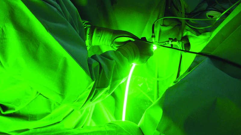 Лазерната операция - най-съвременният метод за лечение на увеличена простата