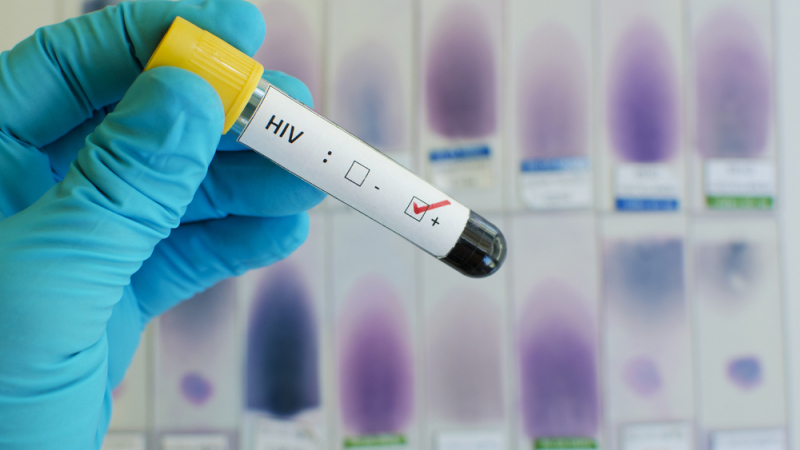 Лекари връщат пациенти с ХИВ – страх ги е да не се заразят 