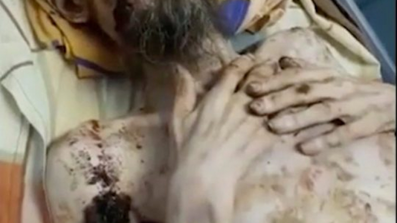 Изненадващи 11-годишни СНИМКИ на "живата мумия", която уж бе ръфана от мечка