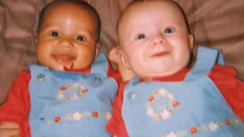 Помните ли близначките с бял и тъмен цвят на кожата? 20 години по-късно те... (СНИМКИ)