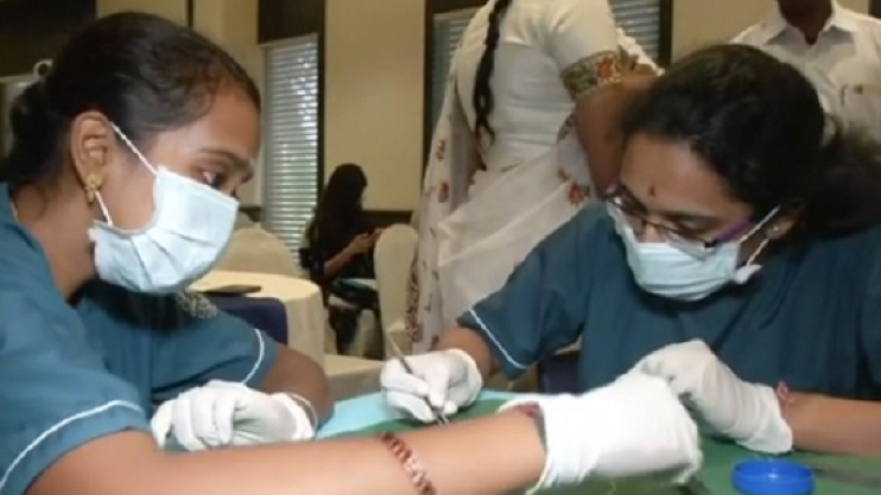 Първи случай в света: Лекари извадиха 526 зъба от устата на дете
