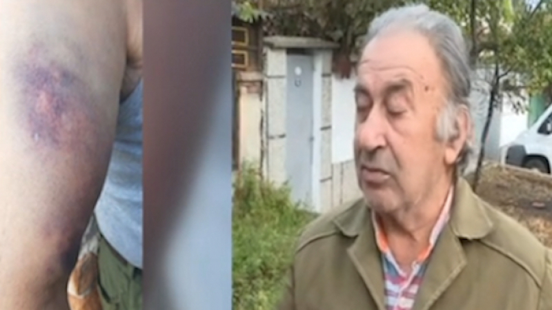 Цигани пребиха брутално старци в Бузовград СНИМКИ