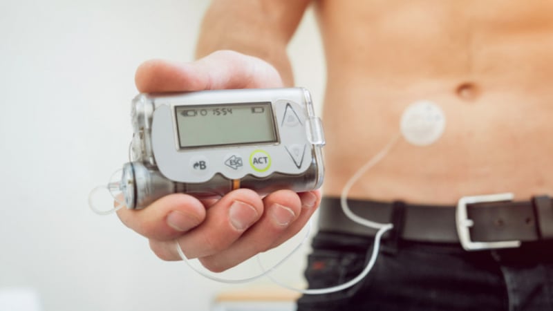 Полага ли се инсулинова помпа по НЗОК на възрастни пациенти?