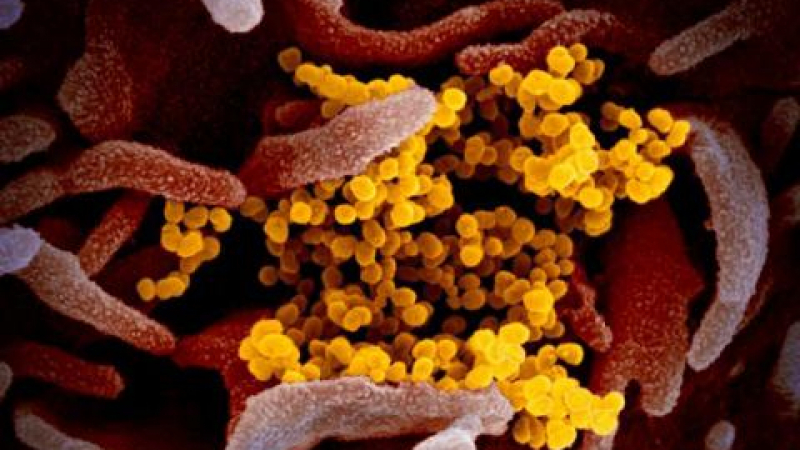 Американците публикуваха плашещи СНИМКИ на китайския коронавирус