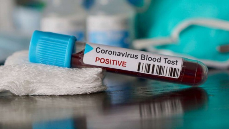 Първи случай на коронавирус в Норвегия