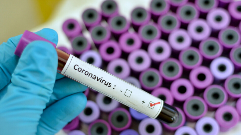 Регистрираха първи случай на енцефалит следствие на коронавирус