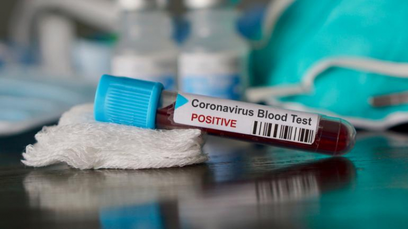 Тревожна информация за заразения с коронавирус в Плевен 