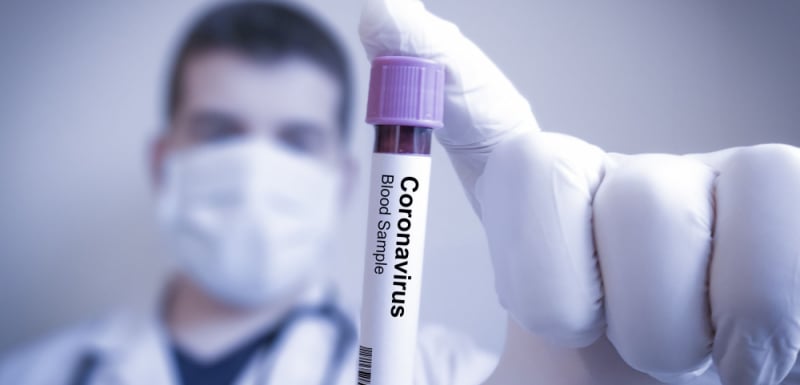 От ВМА огласиха резултатите от 8-те съмнителни проби за коронавирус! 