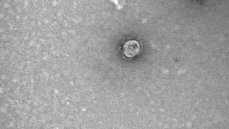 Първи СНИМКИ на коронавируса убиец под микроскоп!