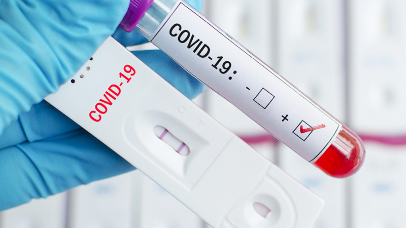 Центърът за контрол на болестите в САЩ с изненадваща новина за PCR тестовете