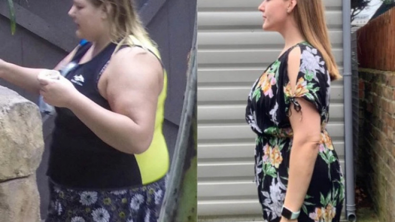 Жена свали 56 кг със своя диета, но гледката под дрехите й е покъртителна СНИМКИ