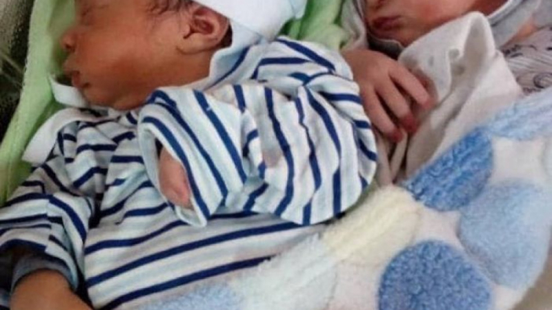 Жена роди близнаци, а лекарите и мъжът й онемяха, щом видяха бебетата СНИМКИ