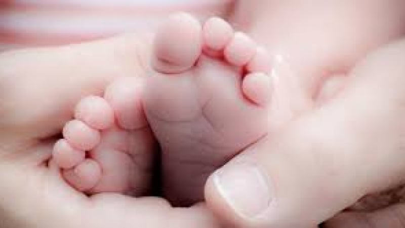 В САЩ се роди бебе с две усти СНИМКА
