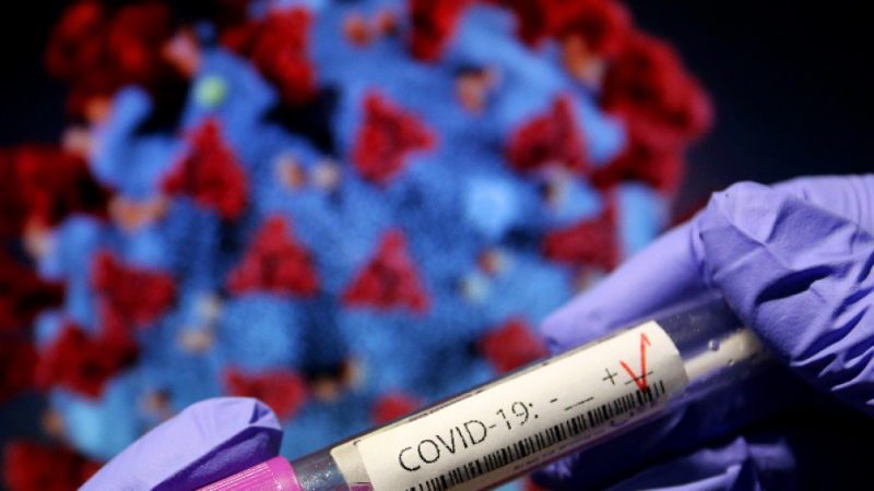 Установиха защо хората от тази кръвна група се заразяват най-често с COVID-19