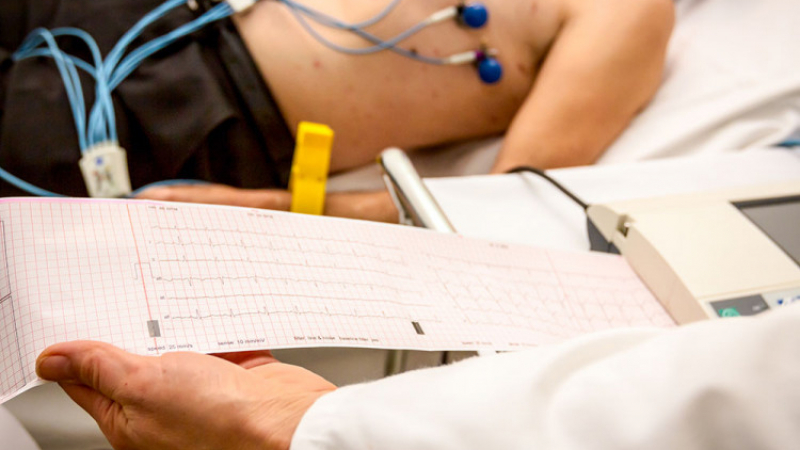 Водещ кардиолог изброи причините за внезапната сърдечна смърт